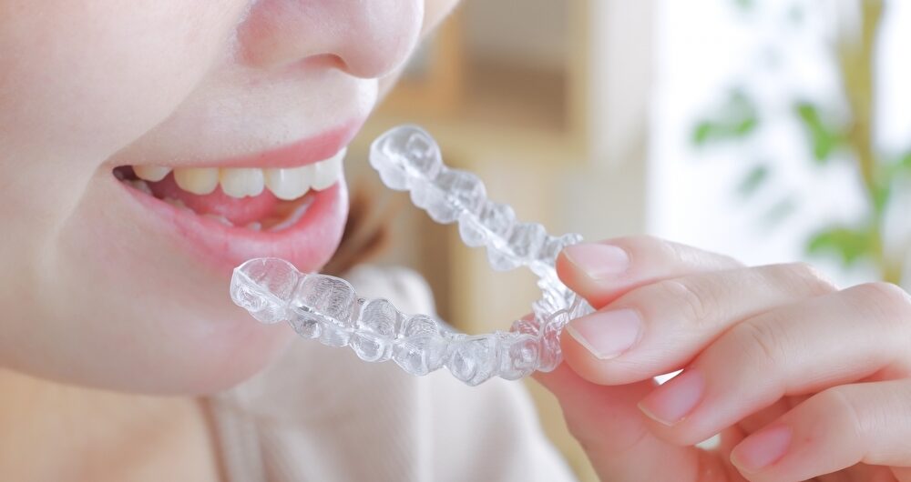 マウスピース矯正